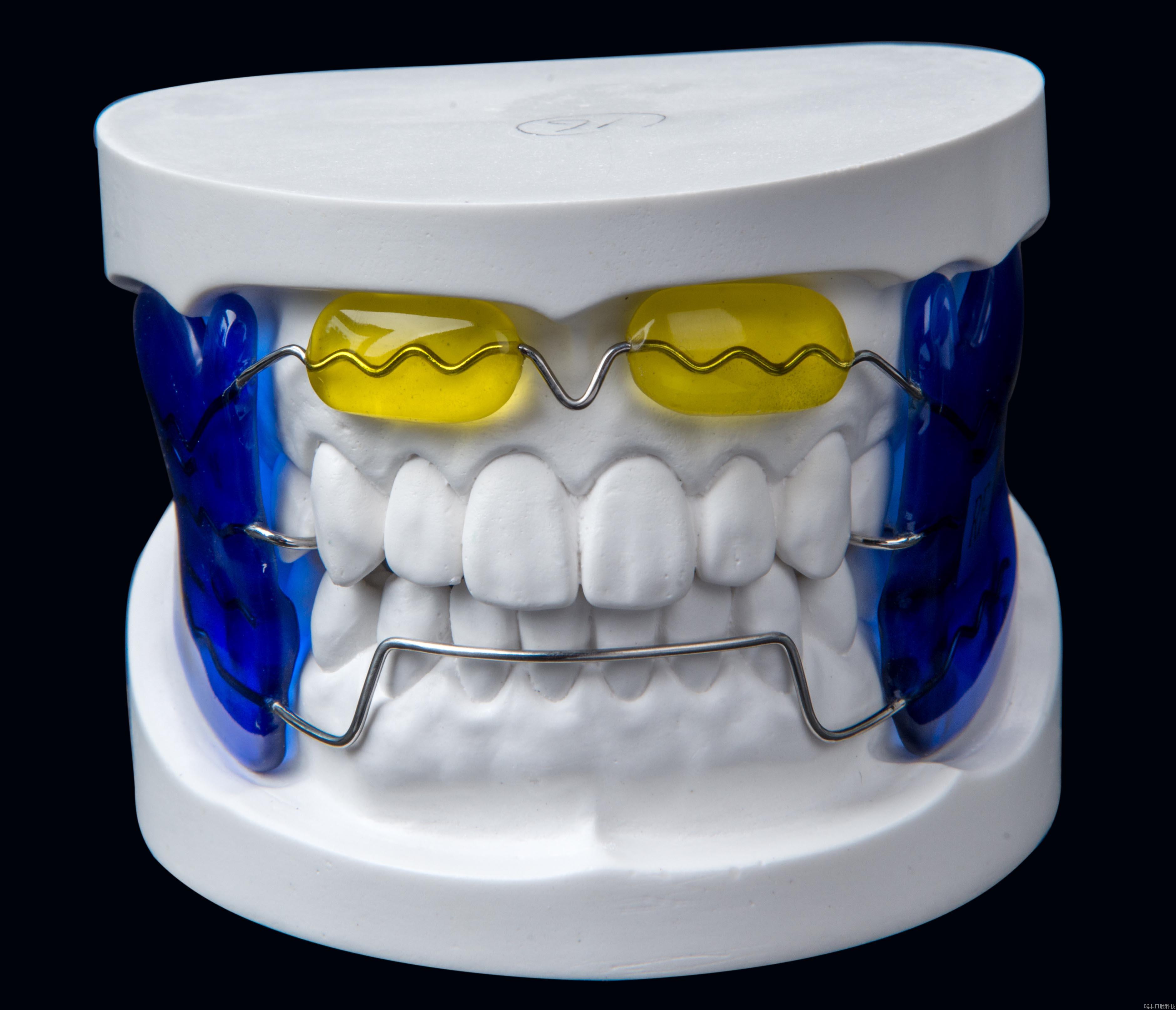 法兰克尔矫正托